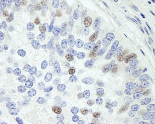 Sin1 Antibody in Immunohistochemistry (Paraffin) (IHC (P))