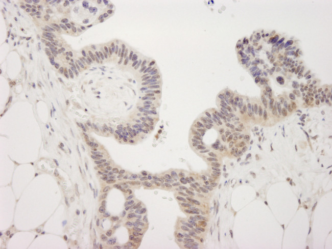 JMJD2A Antibody in Immunohistochemistry (Paraffin) (IHC (P))