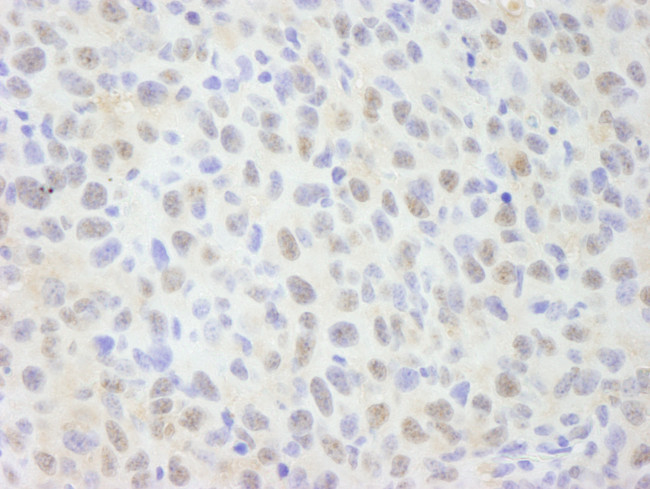 NCOA62 Antibody in Immunohistochemistry (Paraffin) (IHC (P))