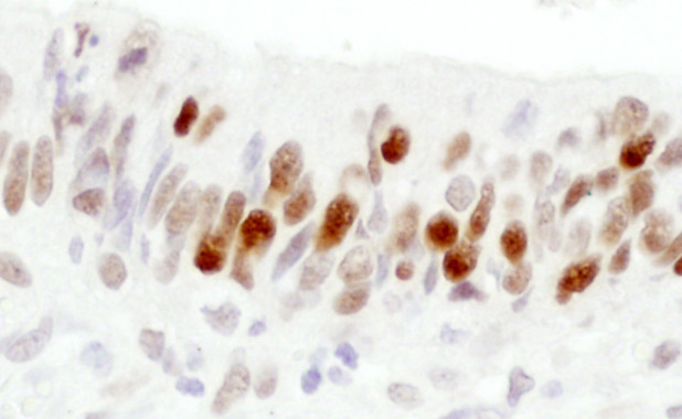 RCH1/KPNA2 Antibody in Immunohistochemistry (Paraffin) (IHC (P))