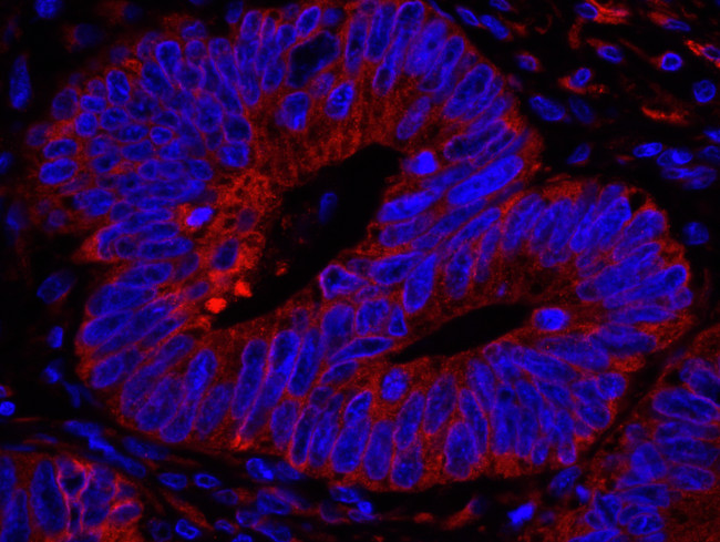 Reticulocalbin-1 Antibody in Immunohistochemistry (Paraffin) (IHC (P))