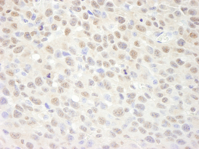 SUPT6H Antibody in Immunohistochemistry (Paraffin) (IHC (P))