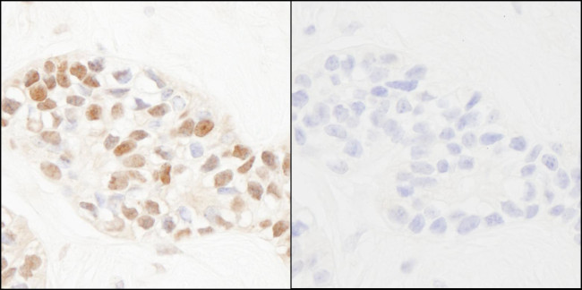 Phospho-PCNA (Tyr211) Antibody in Immunohistochemistry (Paraffin) (IHC (P))