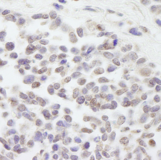 Cul3 Antibody in Immunohistochemistry (Paraffin) (IHC (P))