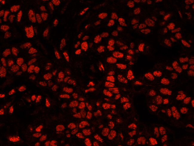 XRN2 Antibody in Immunohistochemistry (Paraffin) (IHC (P))