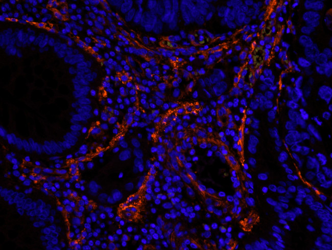 Filamin A Antibody in Immunohistochemistry (Paraffin) (IHC (P))