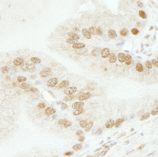 SMARCB1/SNF5 Antibody in Immunohistochemistry (Paraffin) (IHC (P))