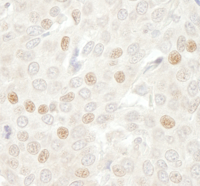 CDC20 Antibody in Immunohistochemistry (Paraffin) (IHC (P))