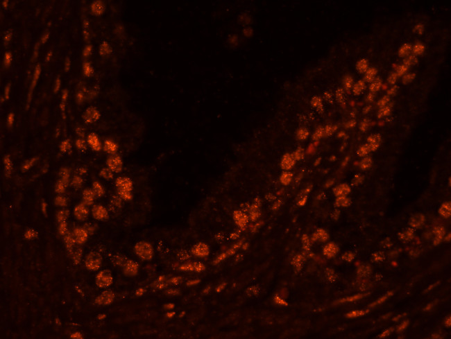 USP47 Antibody in Immunohistochemistry (Paraffin) (IHC (P))