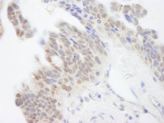 ABI1 Antibody in Immunohistochemistry (Paraffin) (IHC (P))