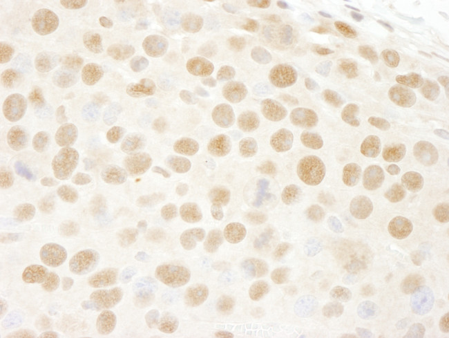 RbBP4 Antibody in Immunohistochemistry (Paraffin) (IHC (P))