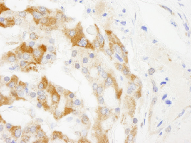 TRIM3/BERP Antibody in Immunohistochemistry (Paraffin) (IHC (P))