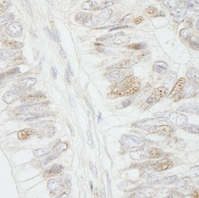 APC Antibody in Immunohistochemistry (Paraffin) (IHC (P))