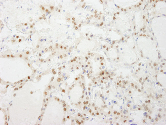 GTF3C4/TFIIIC90 Antibody in Immunohistochemistry (Paraffin) (IHC (P))