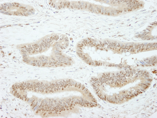 SSH3 Antibody in Immunohistochemistry (Paraffin) (IHC (P))