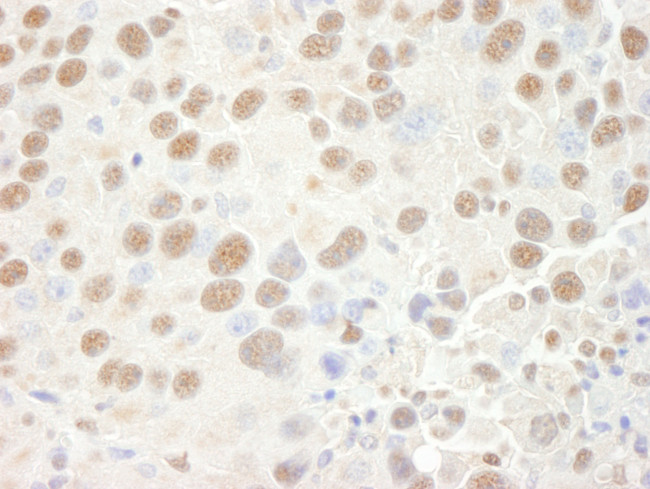 CPSF68 Antibody in Immunohistochemistry (Paraffin) (IHC (P))