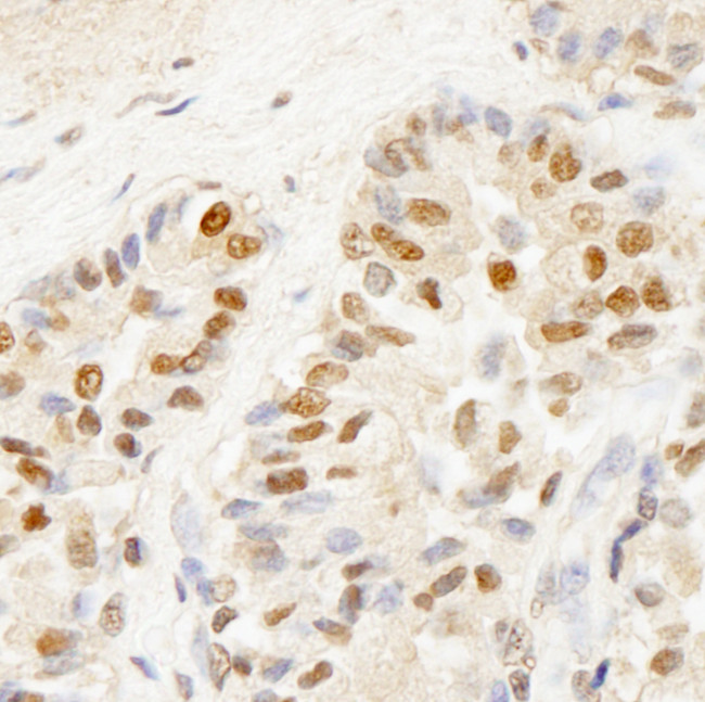 BRF1 Antibody in Immunohistochemistry (Paraffin) (IHC (P))