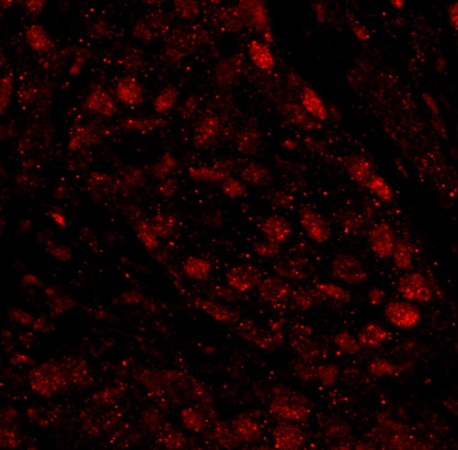 PARP1 Antibody in Immunohistochemistry (Paraffin) (IHC (P))