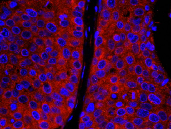 CAD Antibody in Immunohistochemistry (Paraffin) (IHC (P))