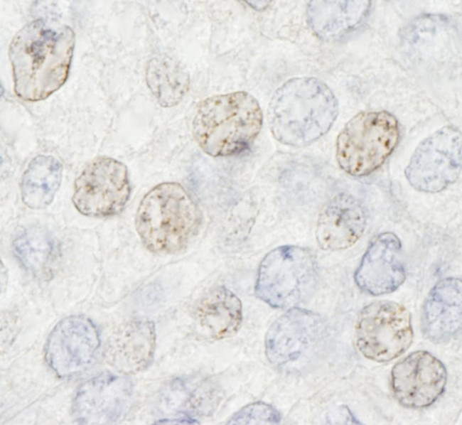 HDAC7 Antibody in Immunohistochemistry (Paraffin) (IHC (P))