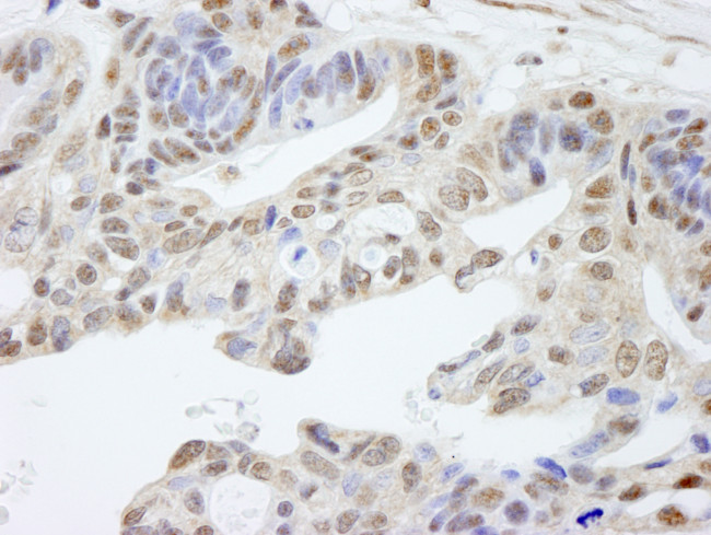 UACA Antibody in Immunohistochemistry (Paraffin) (IHC (P))