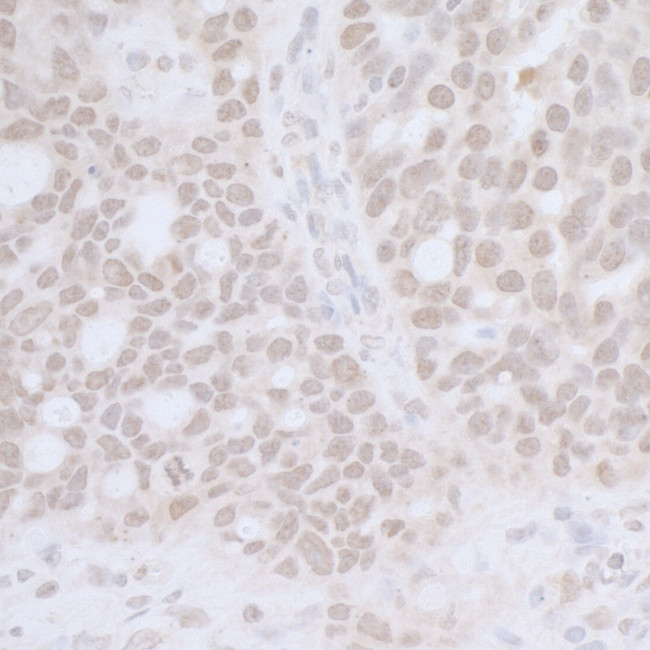 CTR9 Antibody in Immunohistochemistry (Paraffin) (IHC (P))