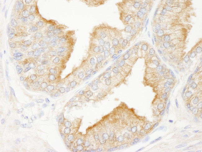 KANK2/SIP Antibody in Immunohistochemistry (Paraffin) (IHC (P))