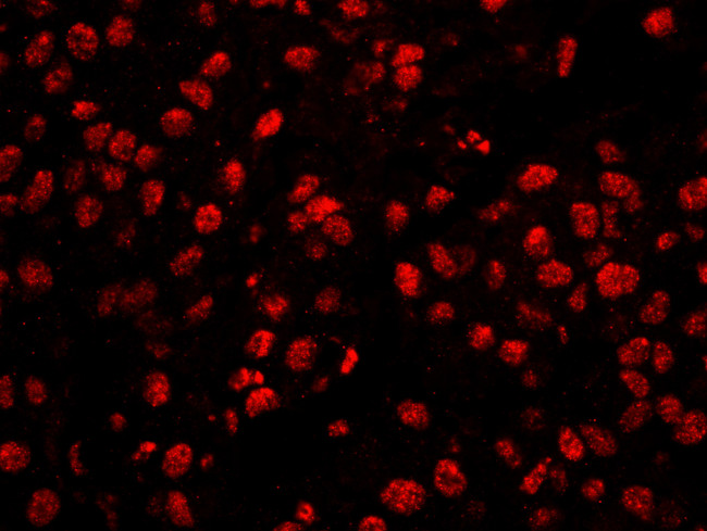 CPSF160 Antibody in Immunohistochemistry (Paraffin) (IHC (P))