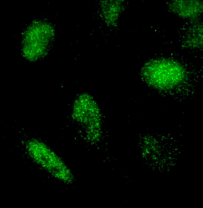 RCOR3 Antibody in Immunocytochemistry (ICC/IF)