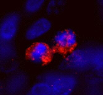 CENP-F/Mitosin Antibody in Immunohistochemistry (Paraffin) (IHC (P))