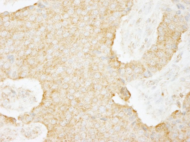 USP3 Antibody in Immunohistochemistry (Paraffin) (IHC (P))