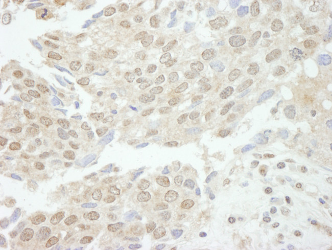 TDP1 Antibody in Immunohistochemistry (Paraffin) (IHC (P))