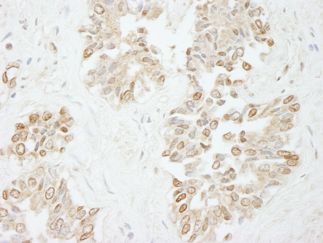 Pol Lambda Antibody in Immunohistochemistry (Paraffin) (IHC (P))