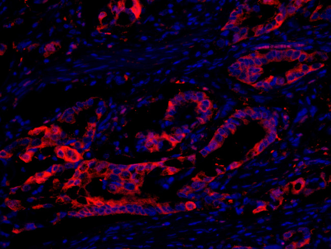 eEF2 Kinase Antibody in Immunohistochemistry (Paraffin) (IHC (P))