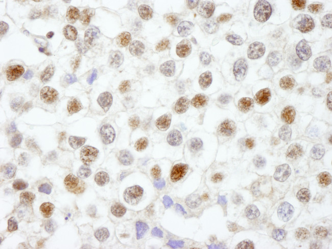 Fen1 Antibody in Immunohistochemistry (Paraffin) (IHC (P))