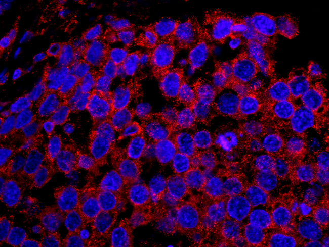 EPS15 Antibody in Immunohistochemistry (Paraffin) (IHC (P))