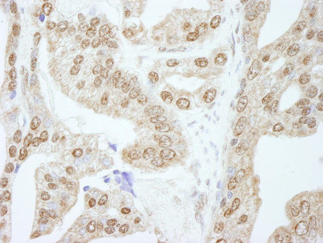 Cyclin E1 Antibody in Immunohistochemistry (Paraffin) (IHC (P))