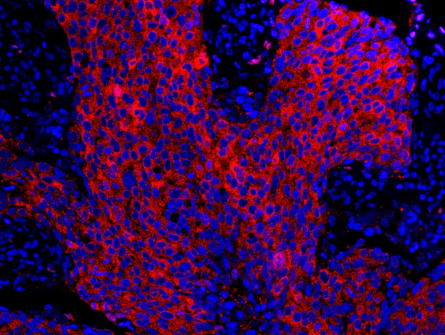 14-3-3 Sigma Antibody in Immunohistochemistry (Paraffin) (IHC (P))