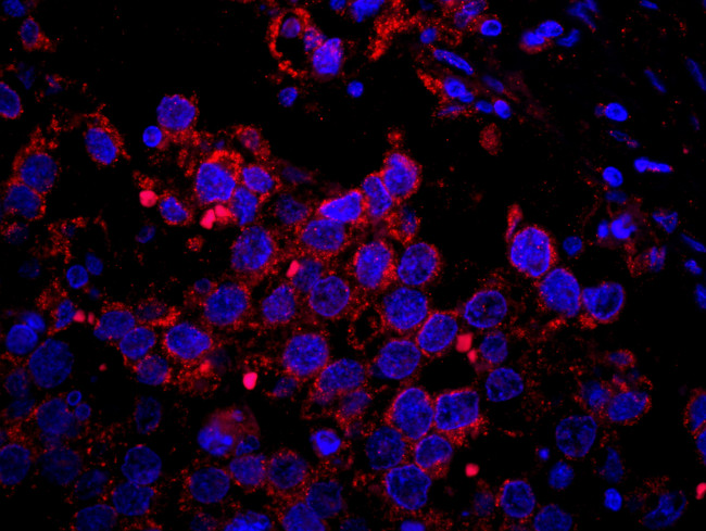 IRS2 Antibody in Immunohistochemistry (Paraffin) (IHC (P))