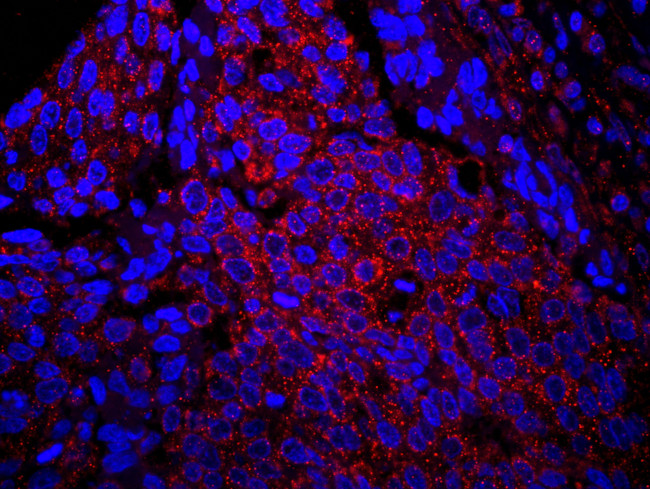 IRS1 Antibody in Immunohistochemistry (Paraffin) (IHC (P))