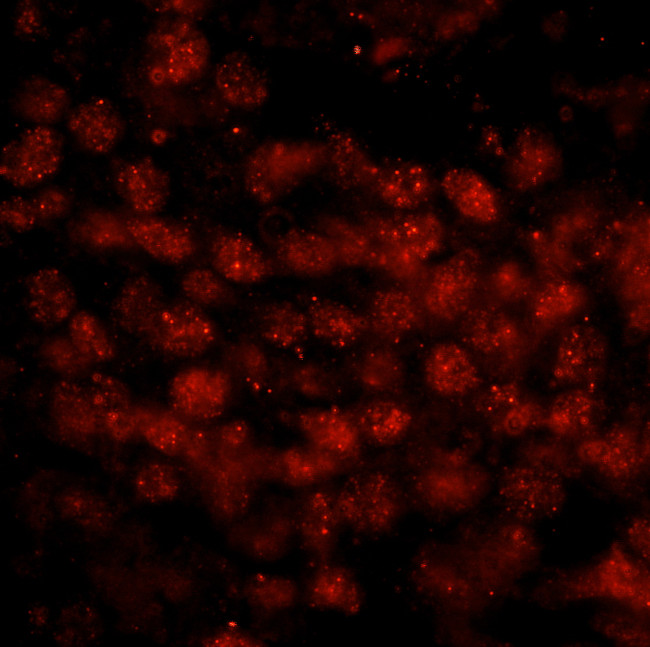 WTAP Antibody in Immunohistochemistry (Paraffin) (IHC (P))