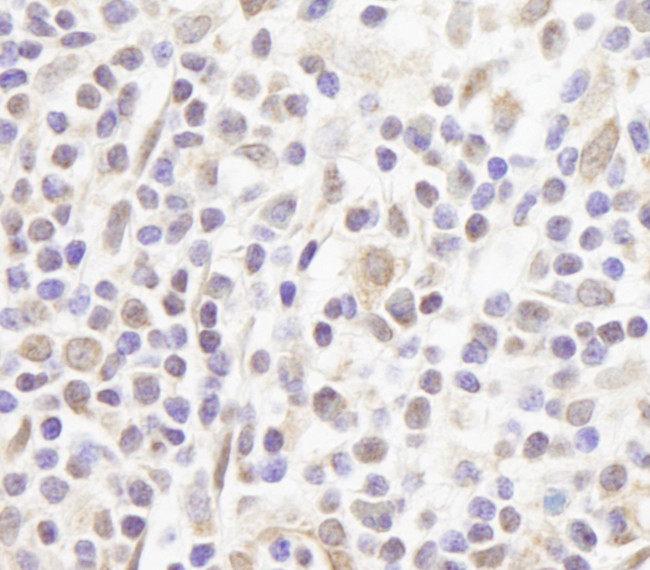 FOG1/ZFPM1 Antibody in Immunohistochemistry (Paraffin) (IHC (P))