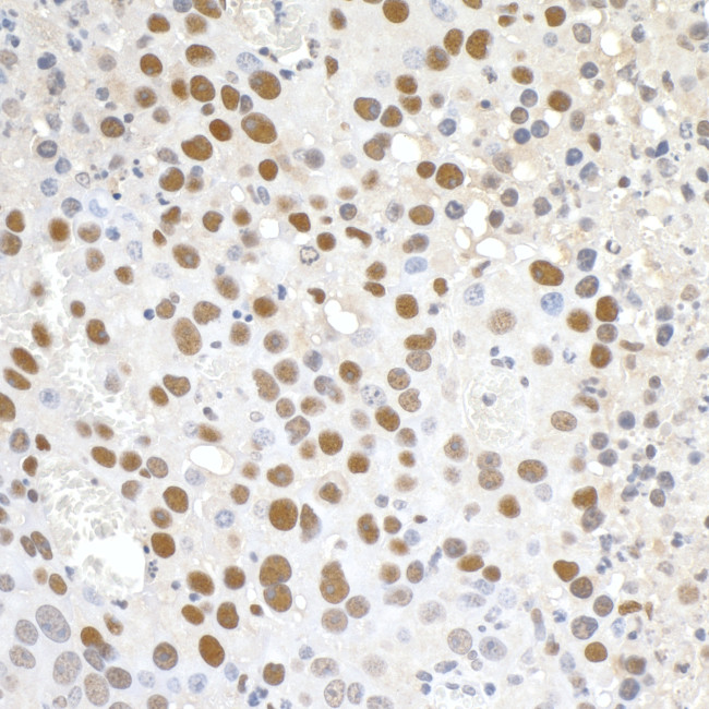 Paf1 Antibody in Immunohistochemistry (Paraffin) (IHC (P))