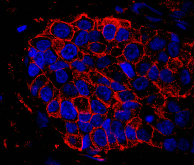 IQGAP1 Antibody in Immunohistochemistry (Paraffin) (IHC (P))