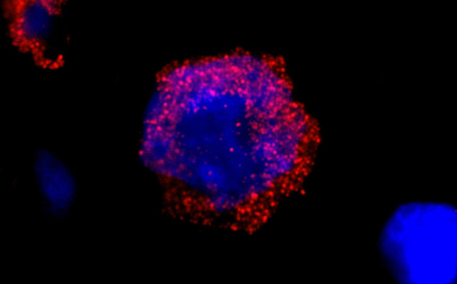 BCR Antibody in Immunocytochemistry (ICC/IF)