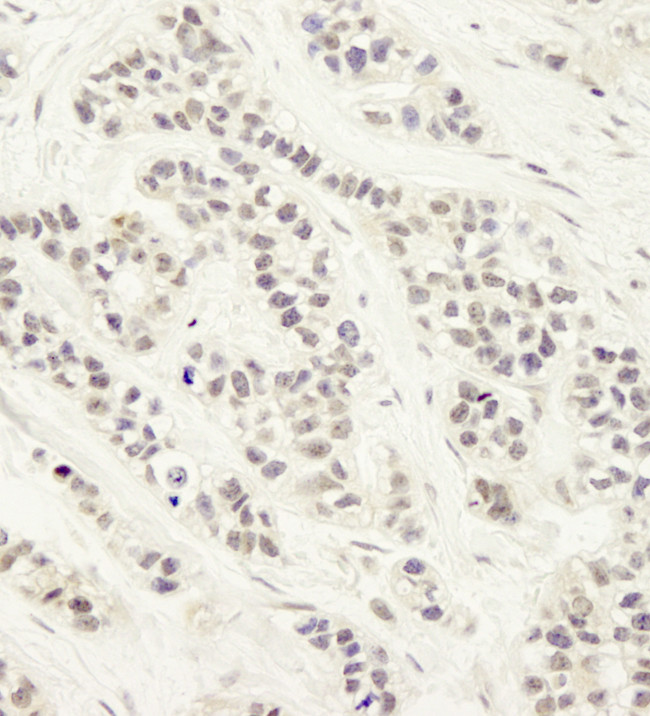 Artemis Antibody in Immunohistochemistry (Paraffin) (IHC (P))