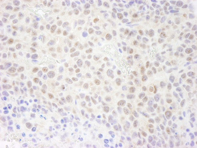 RPA70 Antibody in Immunohistochemistry (Paraffin) (IHC (P))