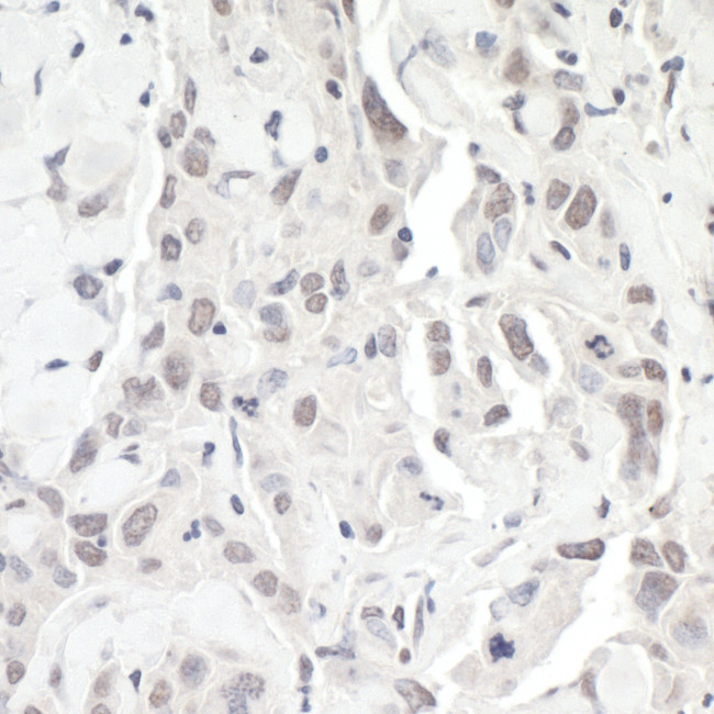 ZEB1 Antibody in Immunohistochemistry (Paraffin) (IHC (P))