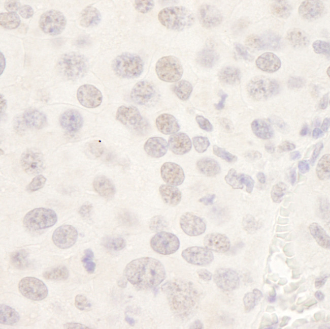 HDAC3 Antibody in Immunohistochemistry (Paraffin) (IHC (P))