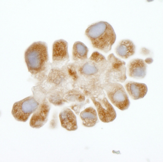 DDX3 Antibody in Immunohistochemistry (Paraffin) (IHC (P))